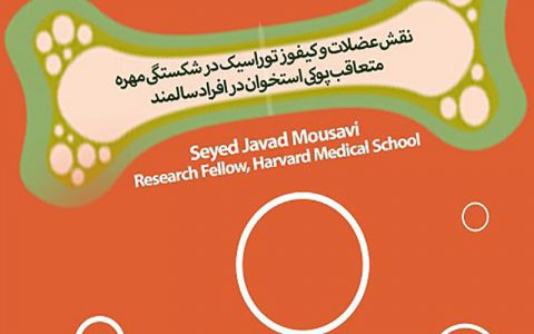 نقش عضلات و کیفوز توراسیک در شکستگی مهره متعاقب پوکی استخوان در افراد سالمند- دکتر جواد موسوی